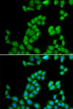 RNASE13 Antibody