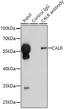 CALR Antibody