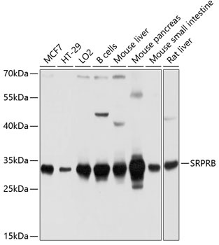 SRPRB Antibody