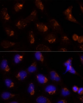 SEC14L2 Antibody