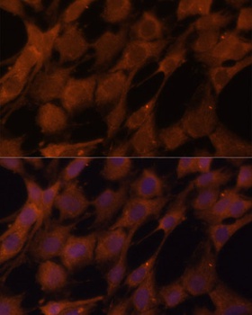 LGMN Antibody