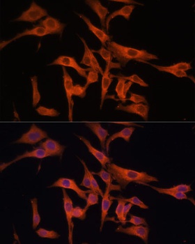LGMN Antibody