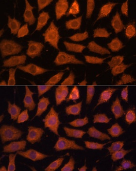 LGMN Antibody