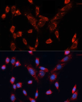 DVL1 Antibody