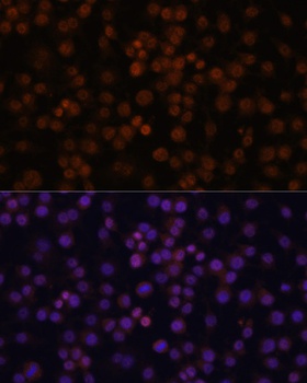 NFKBIZ Antibody