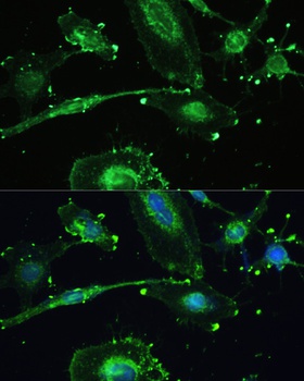 TREM2 Antibody