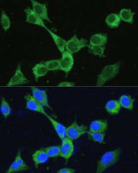 TREM2 Antibody