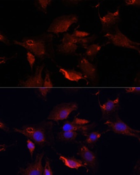 TYMS Antibody
