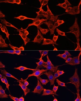 TYMS Antibody