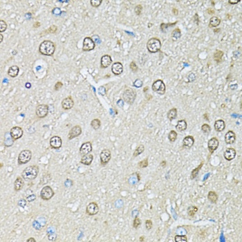 PSMB1 Antibody