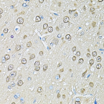 PSMB1 Antibody