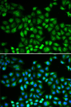 PSMB1 Antibody