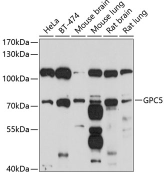 GPC5 Antibody