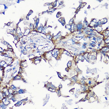 MMP16 Antibody