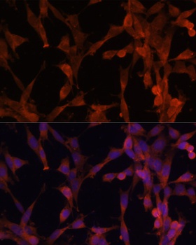 UBE2G2 Antibody