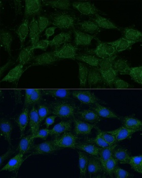 MTHFD2 Antibody