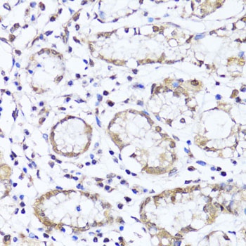 EGLN1/EGLN2 Antibody