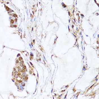 EGLN1/EGLN2 Antibody