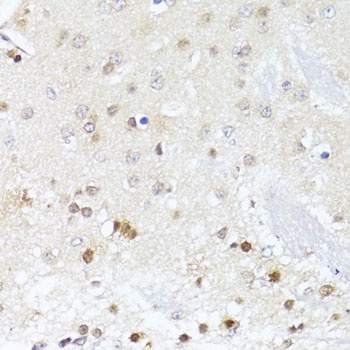 EGLN1/EGLN2 Antibody