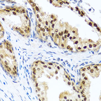 RAD23B Antibody