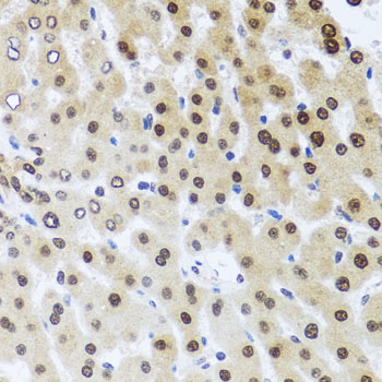 RAD23B Antibody