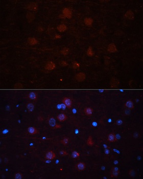 ASPN Antibody