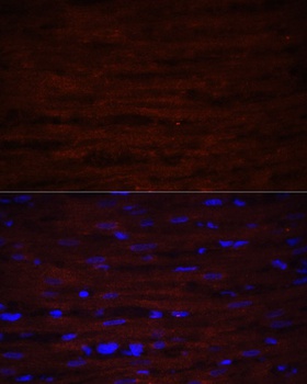 ASPN Antibody