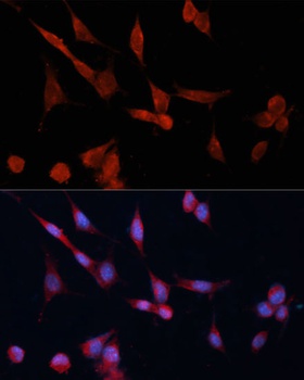 DDAH1 Antibody