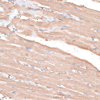 KIF14 Antibody