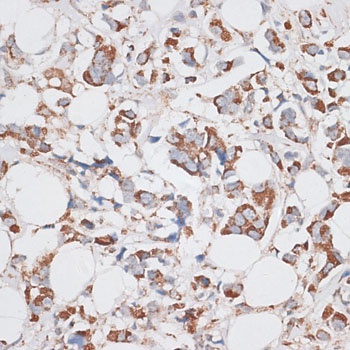 KIF14 Antibody