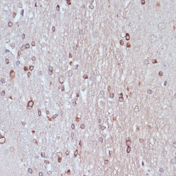 KIF14 Antibody