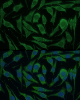 KIF14 Antibody