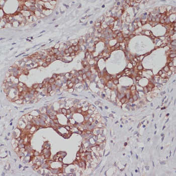 TPD52 Antibody