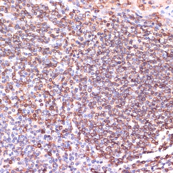 TPD52 Antibody