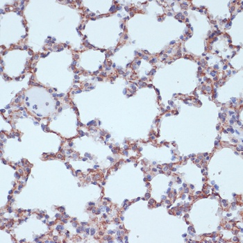 TPD52 Antibody