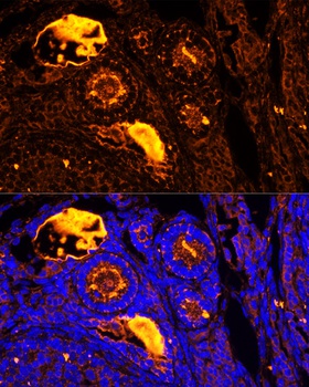 TPD52 Antibody