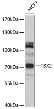 TBX2 Antibody