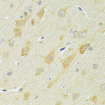 SLC25A1 Antibody