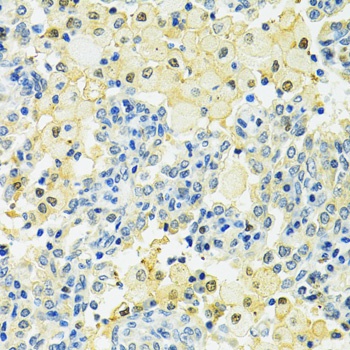 SLC25A1 Antibody
