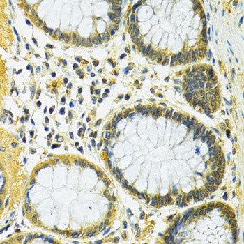 SLC25A1 Antibody