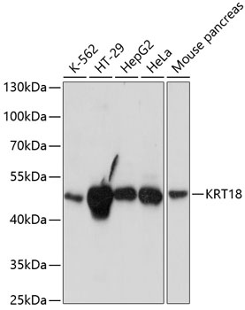 KRT18 Antibody