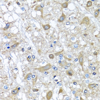 SERPINA3 Antibody