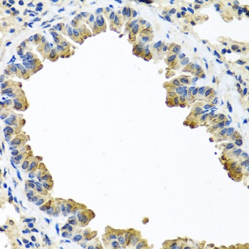 SERPINA3 Antibody