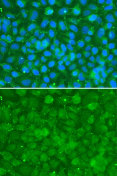 SERPINA3 Antibody