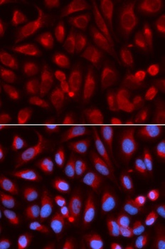 ADA Antibody