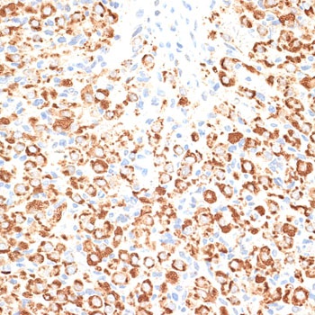 KLHL9 Antibody