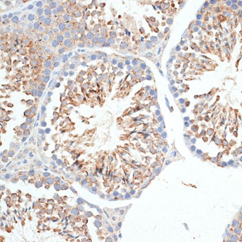 KLHL9 Antibody