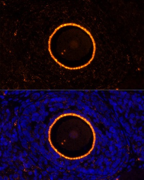 ZP2 Antibody