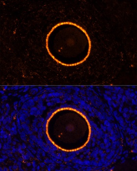 ZP2 Antibody