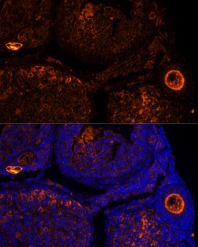 ZP2 Antibody